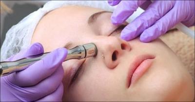 Avanceret ansigtsbehandling med oxygen og diamantslib