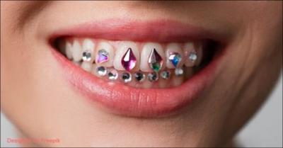 Få et unikt smil med funklende Tooth Gems - Giv dit smil et personligt og stilfuldt touch med Tooth Gems. Vores behandlinger er hurtige, skånsomme og giver et sjovt, moderigtigt resultat, som holder i længere tid. Værdi fra kr. 59,-