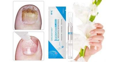 2 stk. effektiv neglepen - sig farvel til neglesvamp