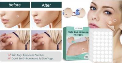 Hudrensende vortefjerningsplaster til skånsom pleje af huden - Praktisk vortefjerningsplaster som hjælper med at reducere vorter og hudmærker. Indeholder 120 plaster i én pakke. Nem og skånsom hudpleje. Værdi kr. 189,-