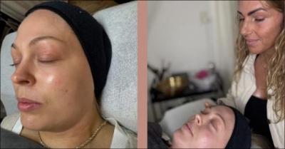 Få smuk glød og fornyet hud med diamantslibning og oxygenlift