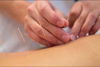 60 minutters akupunktur