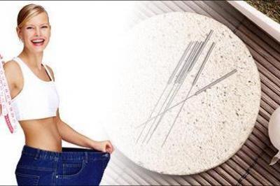 Bestseller: Akupunkturbehandling - til vægttab