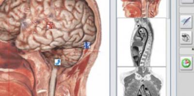 Bio-resonans scanning med evaluering