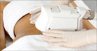 Fedtfrysning på mave eller hofter