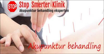 45 minutters akpunktur mod smerter