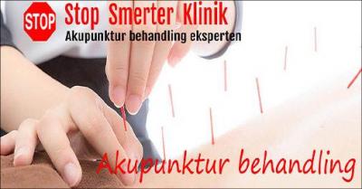 60 minutters kinesisk massage og akupunktur